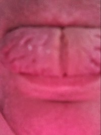 KVANTSS